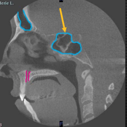 <p>identify the structure </p>