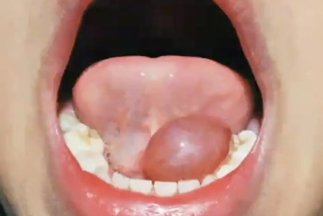 <p>What is the diagnosis?</p>