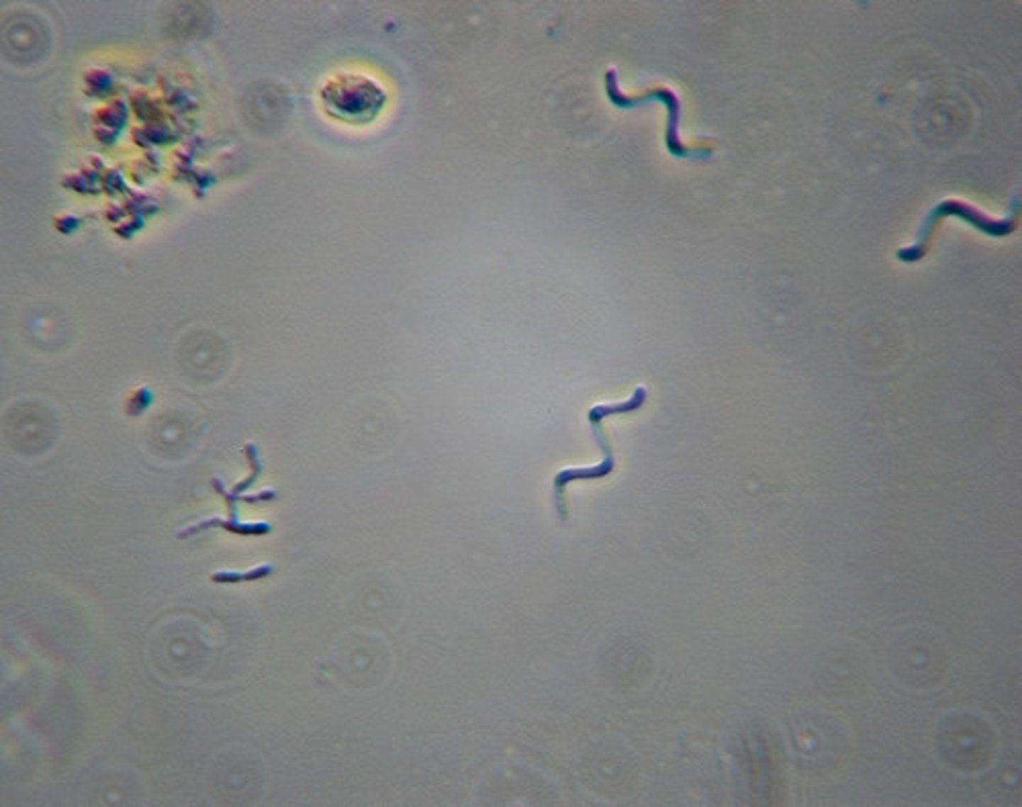<p>spirilla present as individual cells.</p>