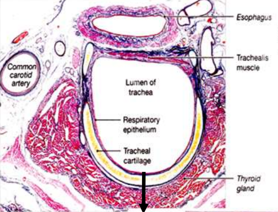<p><strong>Lumen of trachea</strong></p><ul><li><p>Central open space</p></li><li><p>Where air flows</p></li></ul><p><strong>Respiratory epithelium</strong></p><p>This is VERY important. Full name (learn this):</p><p></p><figure data-type="blockquoteFigure"><div><blockquote><p><strong>Pseudostratified ciliated columnar epithelium with goblet cells</strong></p></blockquote><figcaption></figcaption></div></figure><p></p><p>Break it down:</p><ul><li><p><strong>Ciliated</strong> → move mucus</p></li><li><p><strong>Goblet cells</strong> → secrete mucus</p></li><li><p><strong>Columnar cells</strong> → tall cells for surface interaction</p></li></ul><p></p><p>Function:</p><p></p><figure data-type="blockquoteFigure"><div><blockquote><p>Traps particles and moves them OUT of the lungs</p></blockquote><figcaption></figcaption></div></figure><p><strong>Trachealis muscle</strong></p><ul><li><p>Smooth muscle at the open end of cartilage rings</p></li><li><p>Contracts to:</p><ul><li><p>Reduce tracheal diameter</p></li><li><p>Increase airflow velocity (e.g. coughing)</p></li></ul></li></ul><figure data-type="blockquoteFigure"><div><blockquote><p>“The trachealis muscle allows flexibility and regulates airflow.”</p></blockquote><figcaption></figcaption></div></figure><p><strong>Tracheal cartilage</strong></p><ul><li><p>Hyaline cartilage</p></li><li><p>Prevents airway collapse</p></li></ul><p>If you see cartilage → think <strong>airway support</strong></p>