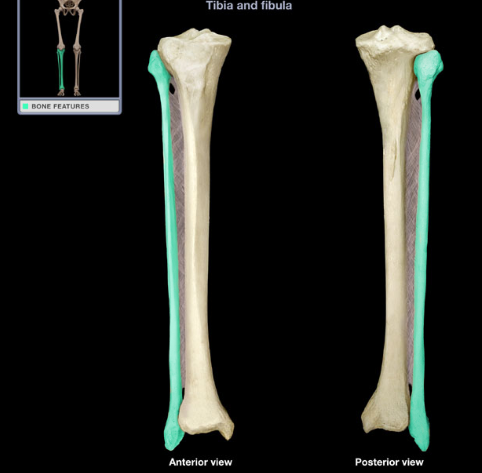 <p>Fibula!</p>