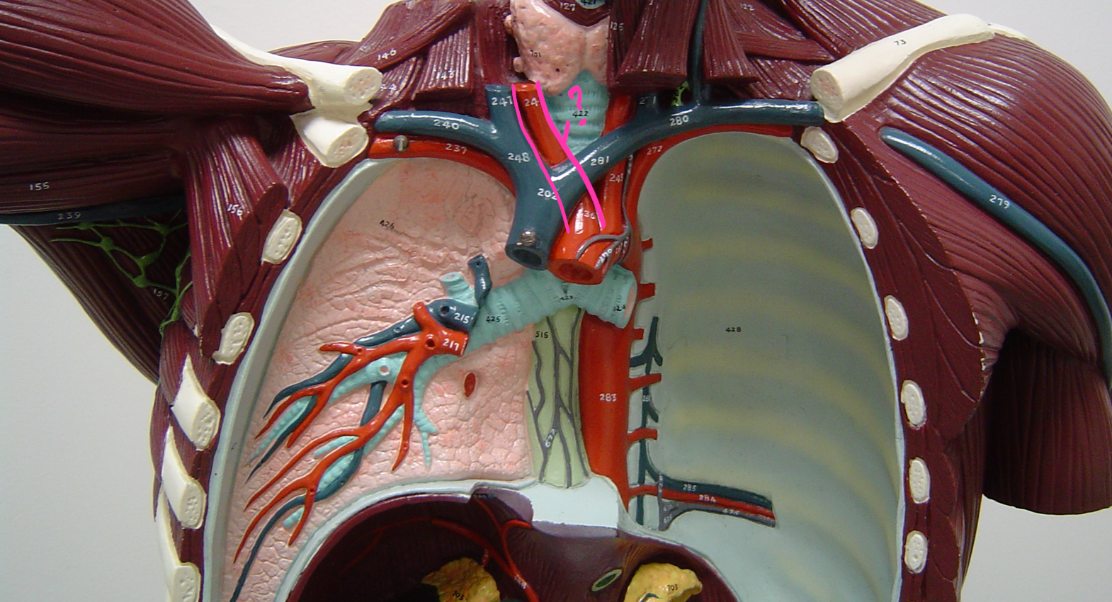 <p>what blood vessel is this? (in pink) (<span><span>major artery to the forelimbs and head)</span></span></p>