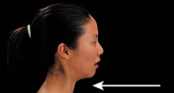 <p><span><span>Special movement of a protracted back to the anatomical position. </span></span></p>