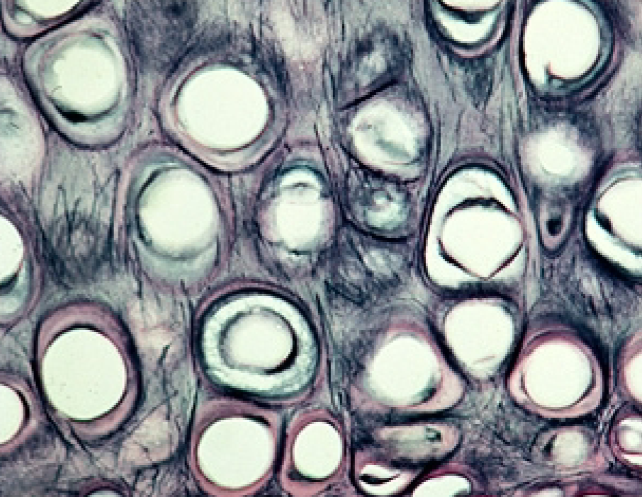 <p>What is the function of the Elastic Cartilage (connective tissue)?</p>