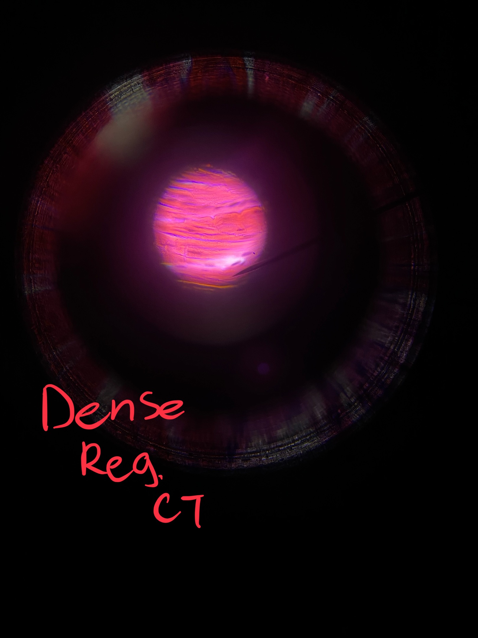 term image