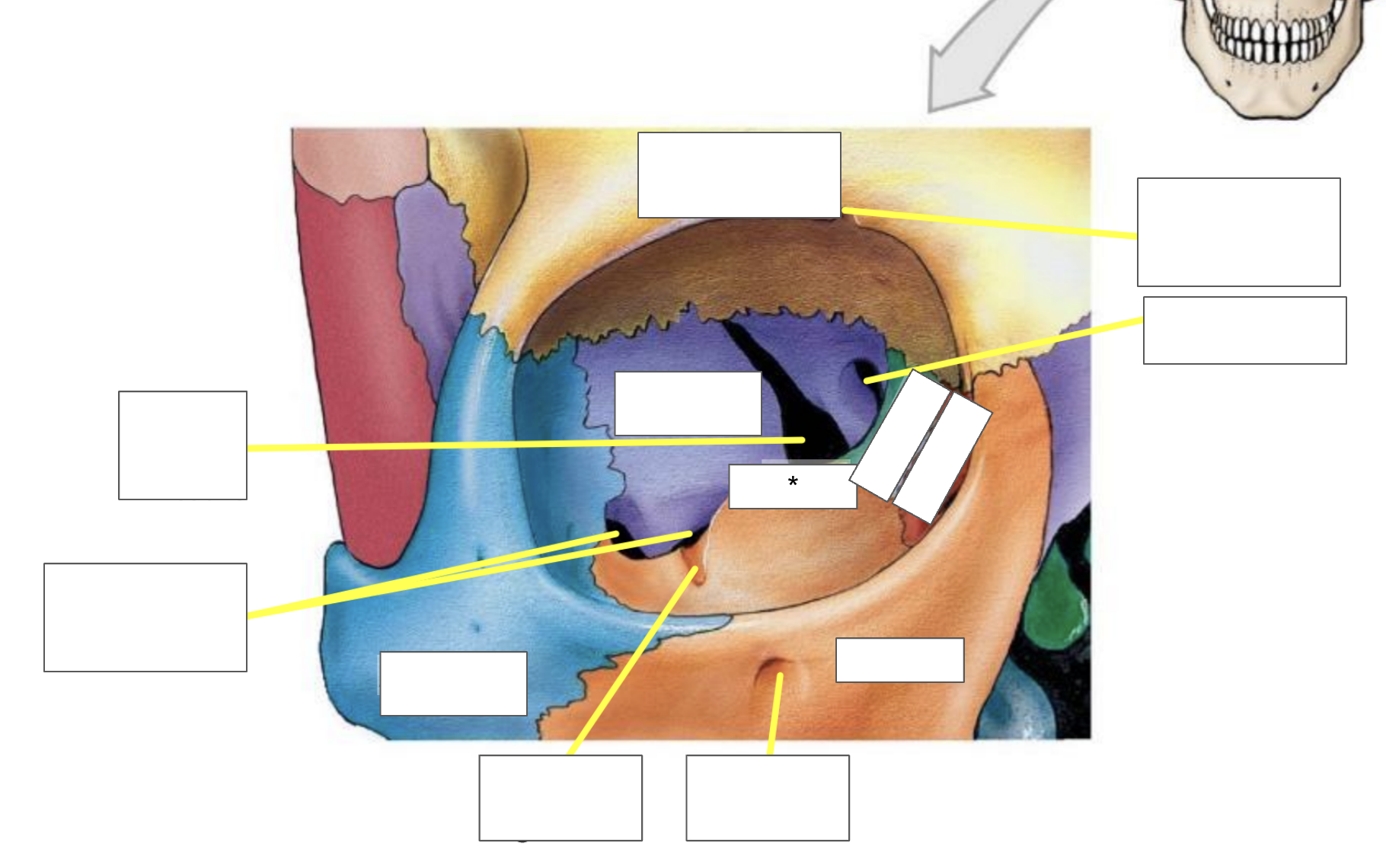 term image