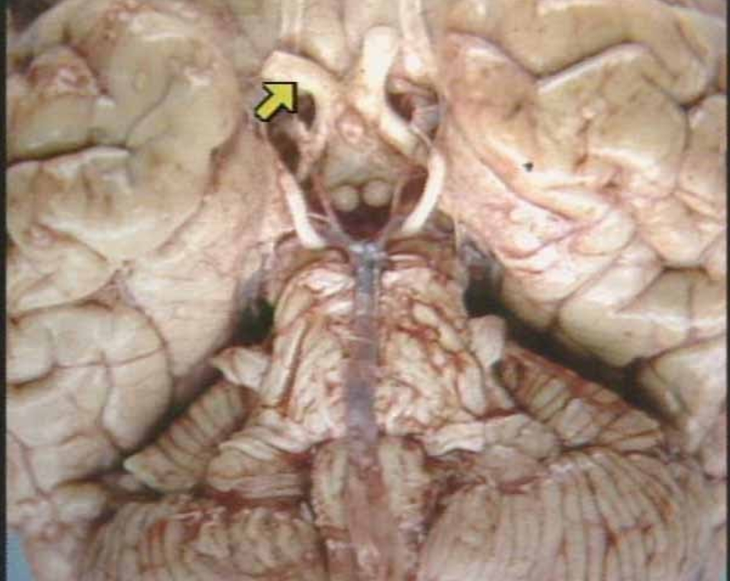 <p>What is the arrow pointing at?</p>