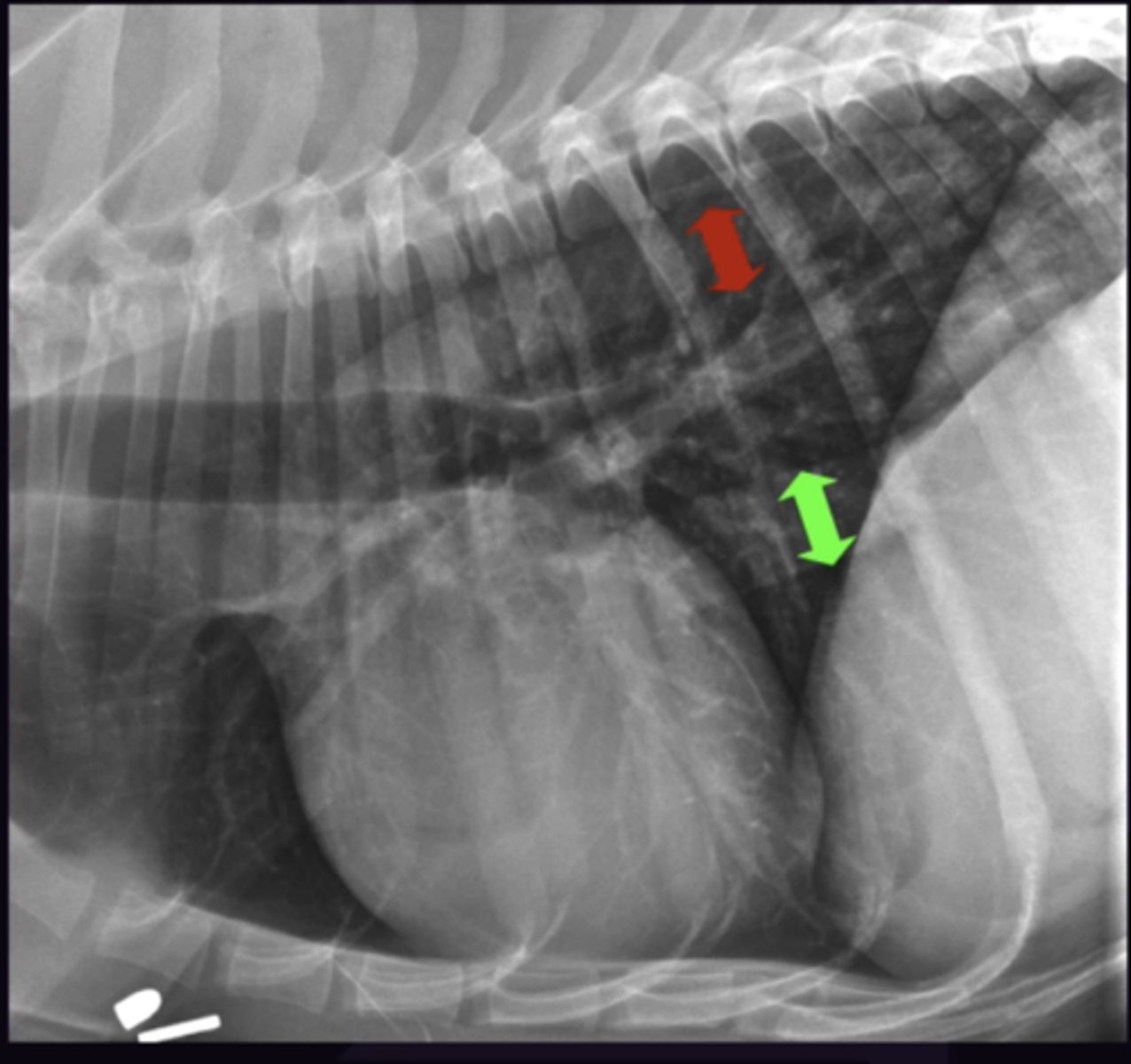 <p>1. Varies with cardiac cycle so care when calling it small/dilated</p><p>2. Dilated if 1.5x the width of the Aorta on the lateral view</p>