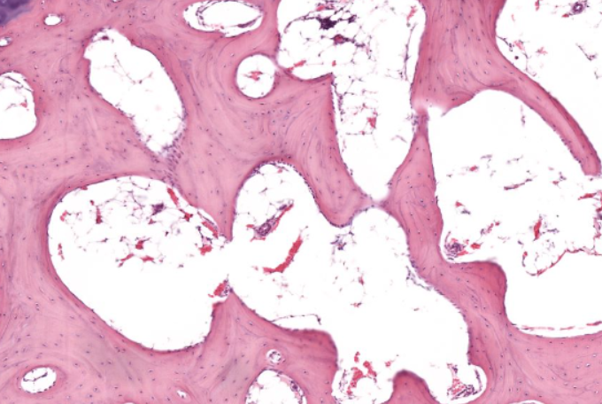 <p>spiky projections that are found in developing bone</p>