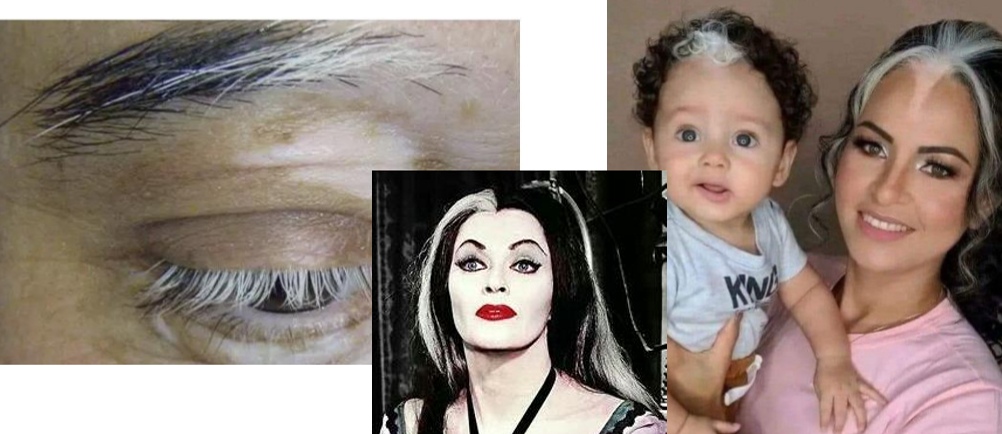 <p>What eyelash condition is this?</p>