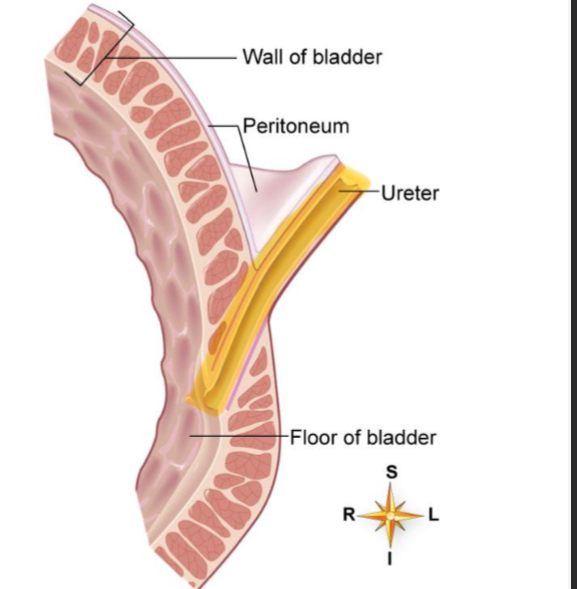 <p>Ureter insertion to bladder</p>