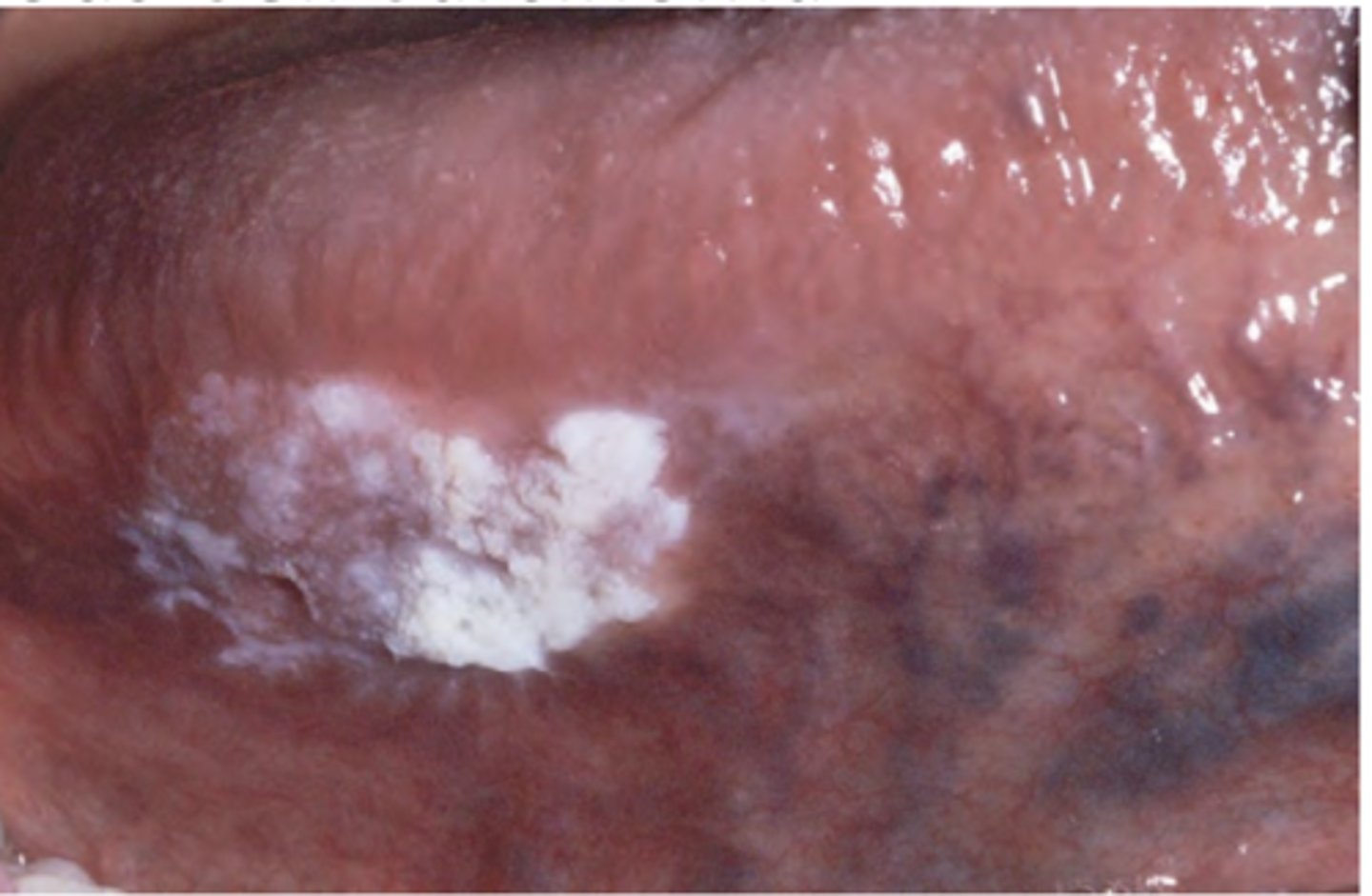 <p>Hint: Varied clinical presentation</p>