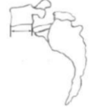 <p>identify grade</p>