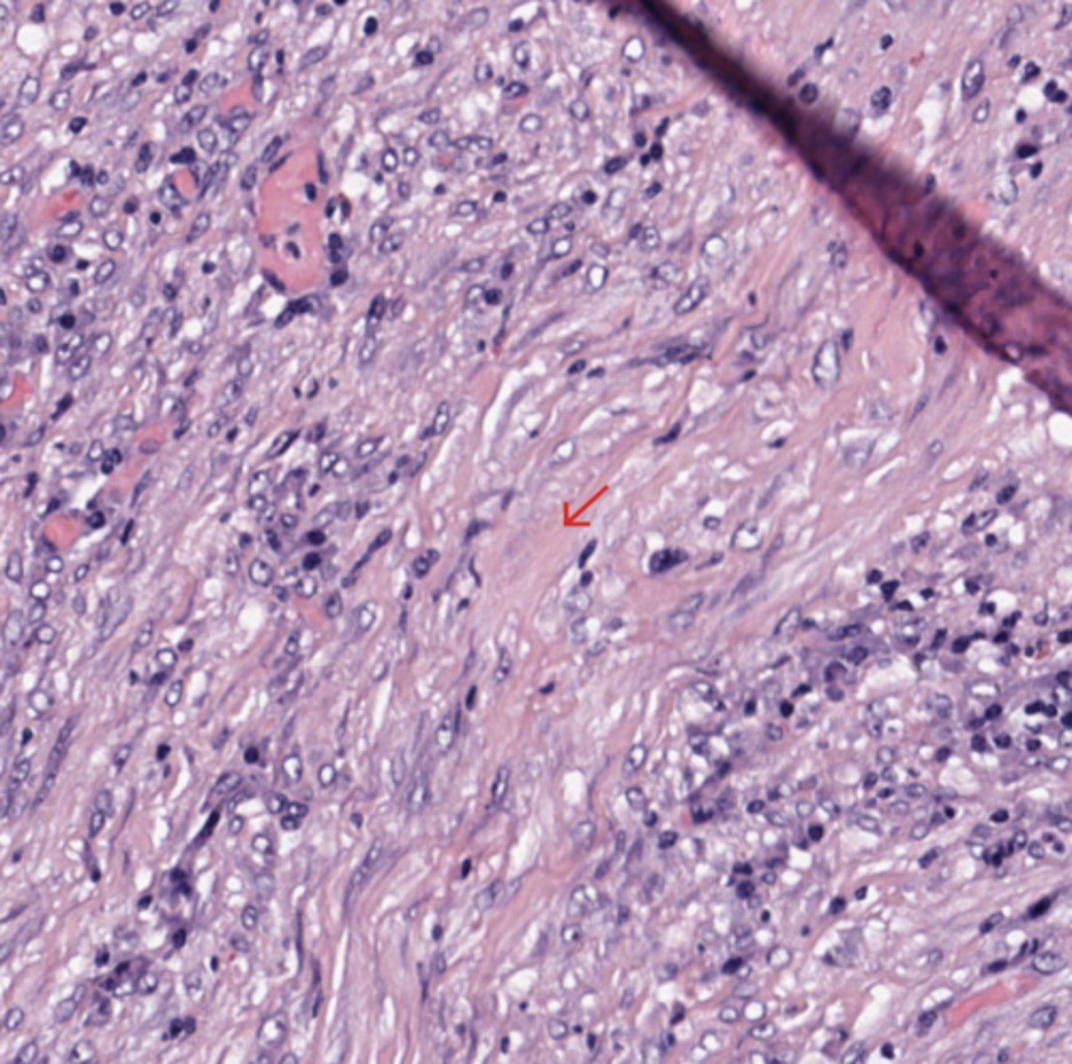 <p>Colon</p>