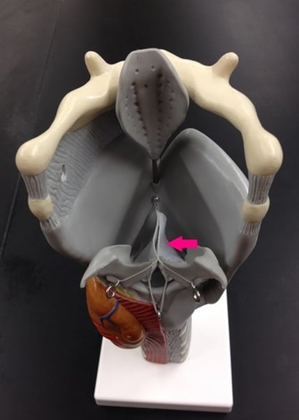 <p>These would be the inferior folds on other models.</p>
