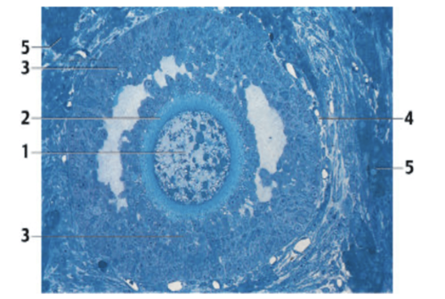 <p>What is the structure in the section?</p><p>A. Primordial follicle</p><p>B. Primary follicle</p><p>C. Secondary follicle /antral follicle</p><p>D. Mature follicle/ Graafian follicle</p>