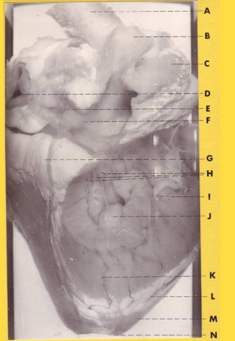 <p>What is N?</p>