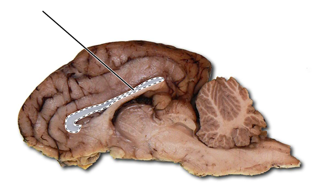 <p>Name the part of the brain that is highlighted.</p>