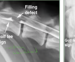 <p><span><span>Identify the pathology?</span></span></p>