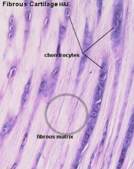 <p>Fibrocartilage</p>