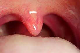 <p>The small, fleshy extension at the back of the throat that swings during swallowing is known as the <strong><em></strong></em>__.</p>
