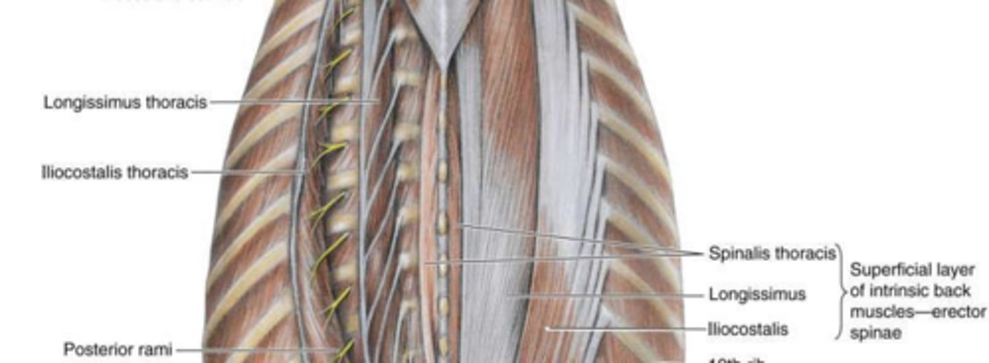 <p>Attachments: Spinous process to spinous process. Action: Bilaterally extends; unilaterally laterally bends vertebral column. Innervation: Posterior rami of C1-L5.</p>