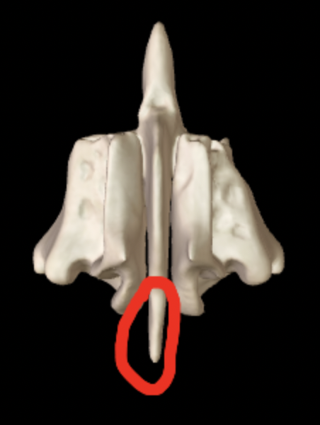 <p>What part of the ethmoid is this? </p>