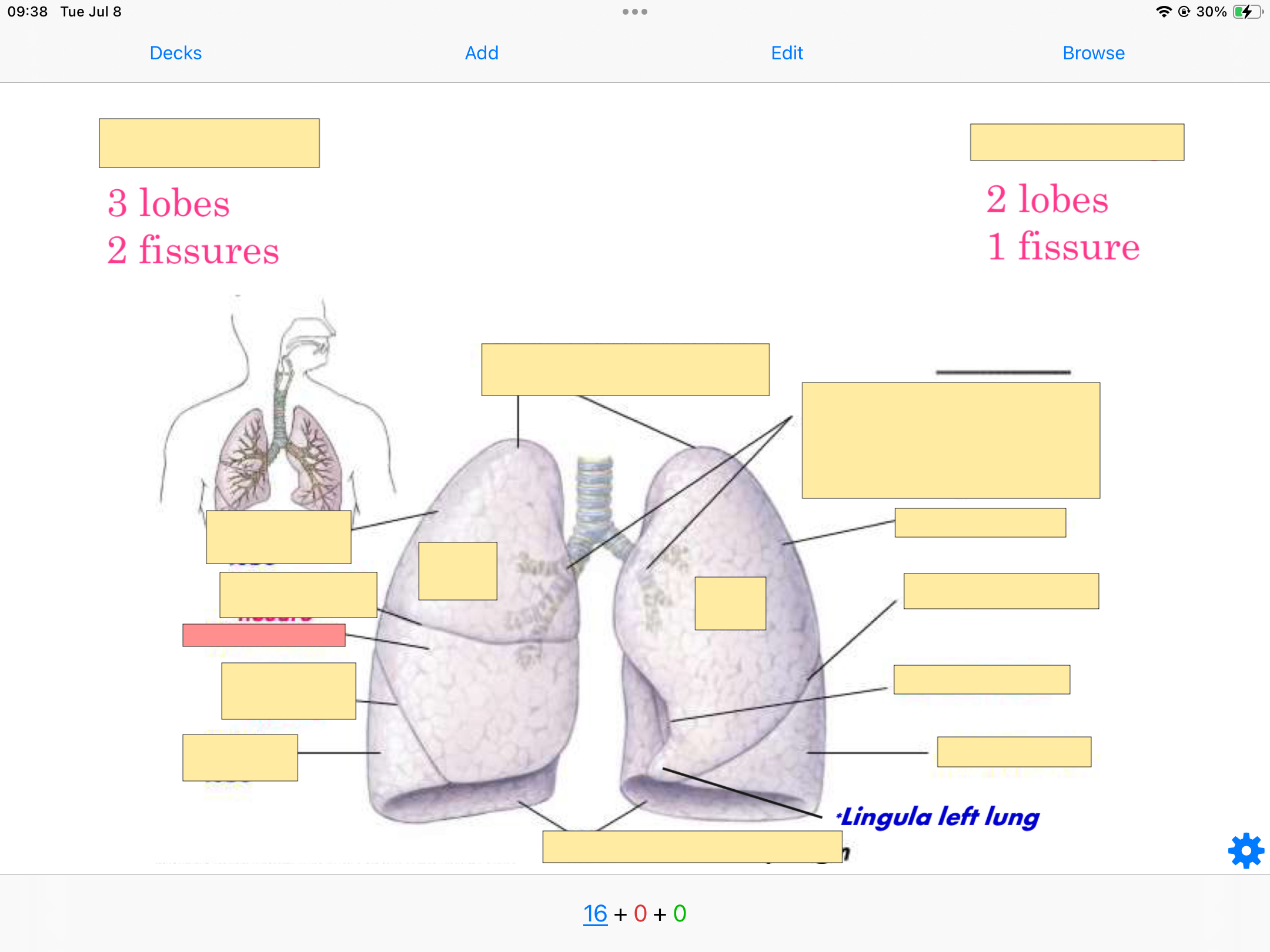 <p>What lobe is this?</p>