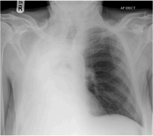 <p>What is this pathology?</p>