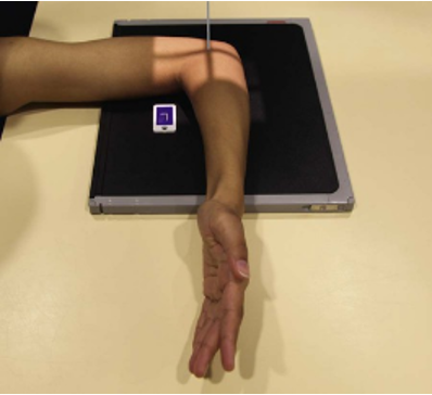 <p>What position would the radial tuberosity face for this position?</p>