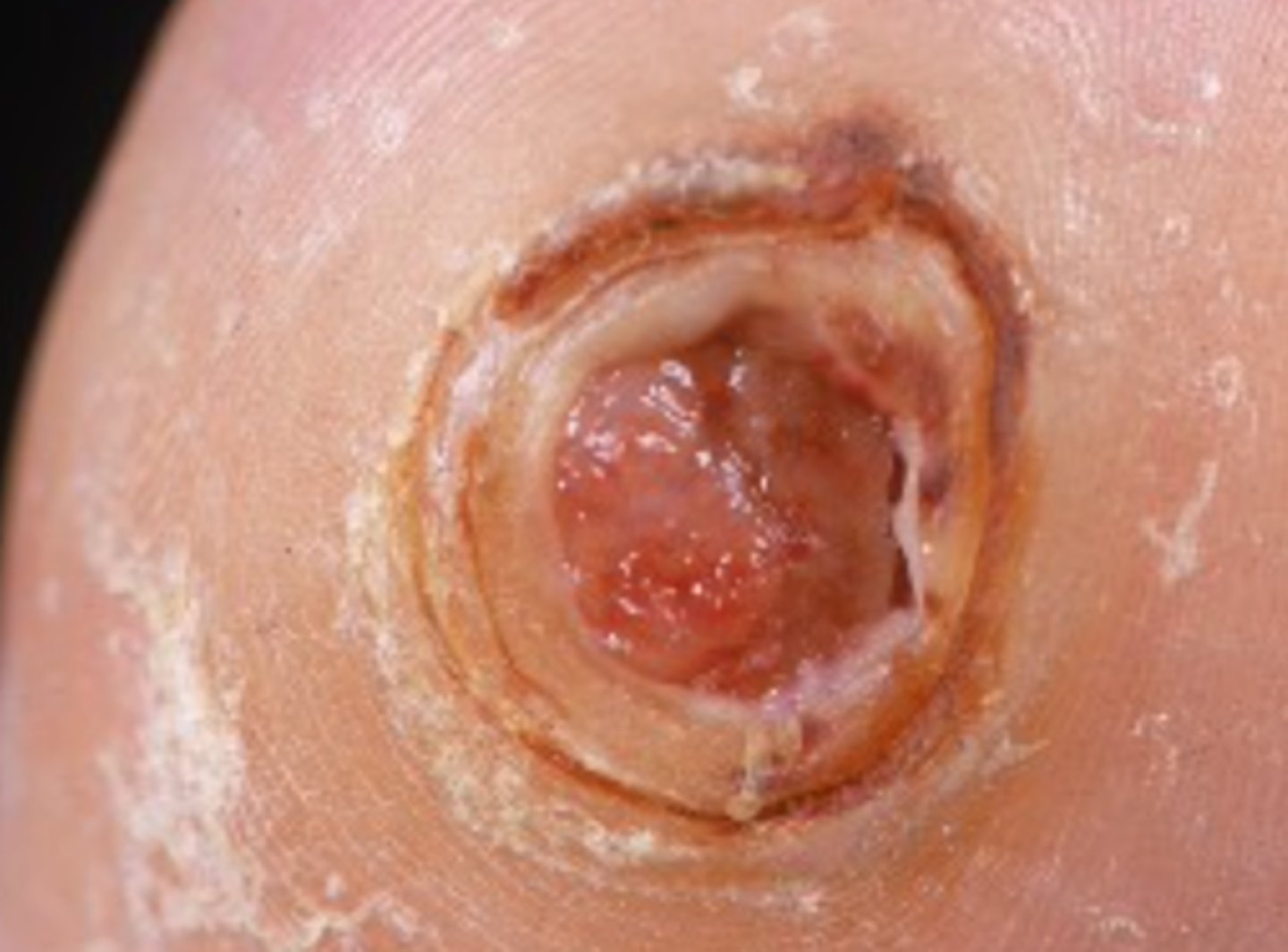 <p>What is the diagnosis?</p>