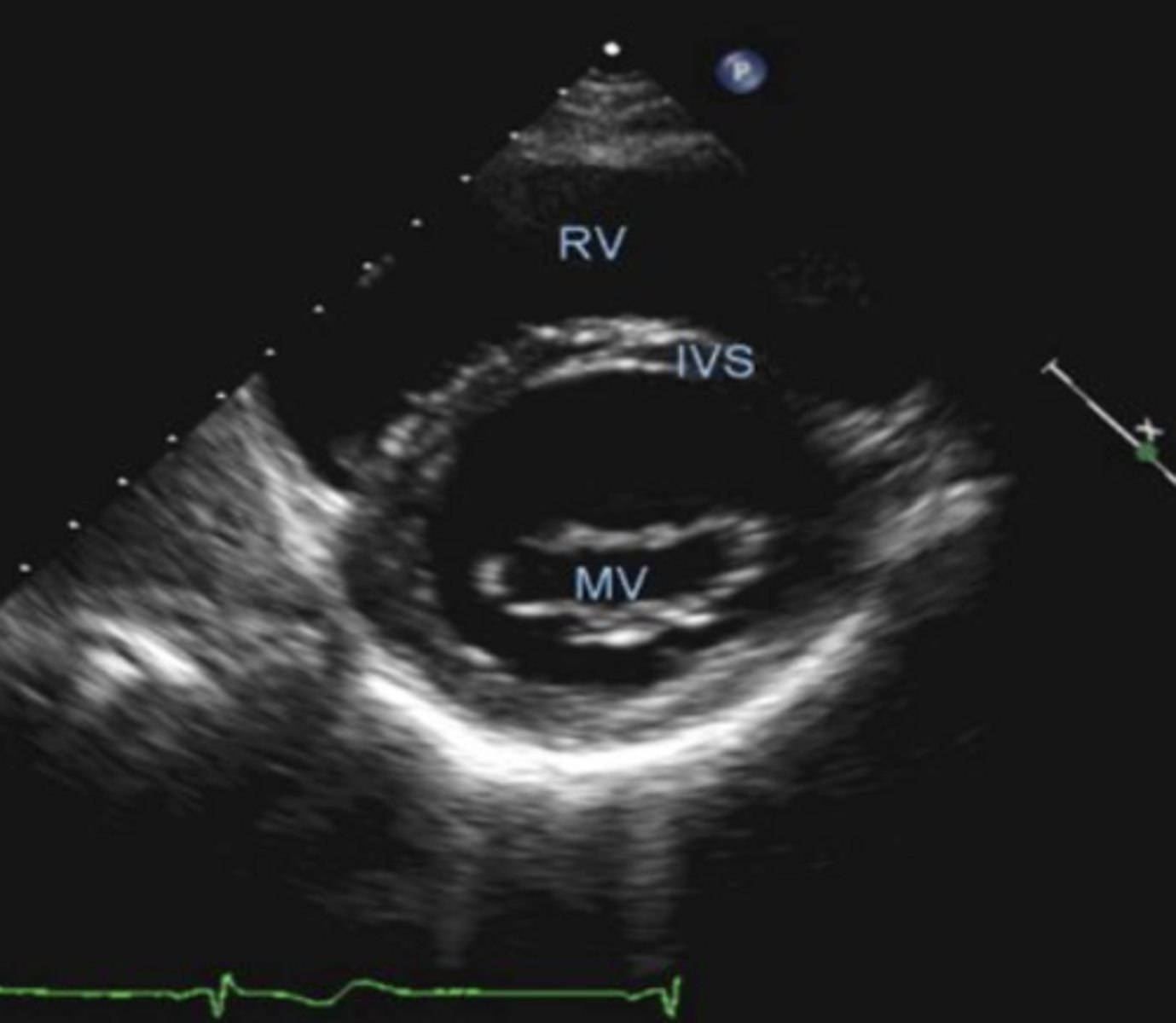 <p>PSSA MV is used to visualize _____</p>