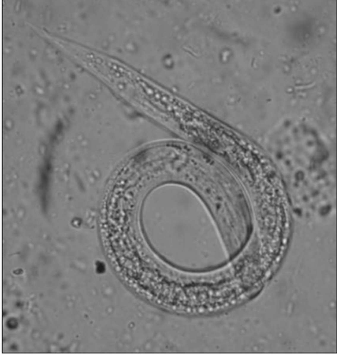 <p>What is this parasite? What characteristic/s did you use to identify it?</p>
