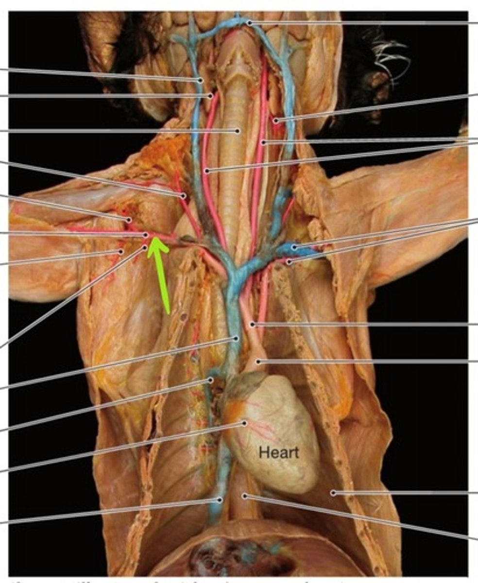<p>identify this artery</p>