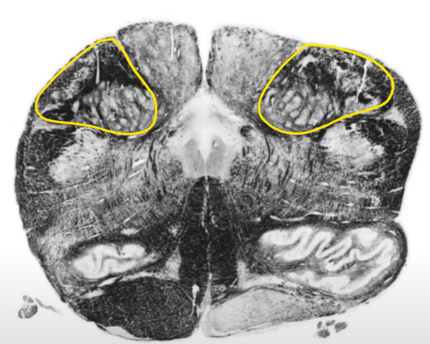 <p>ID the light area</p>