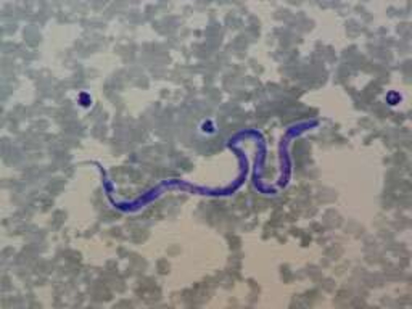 <p>Heartworm</p>