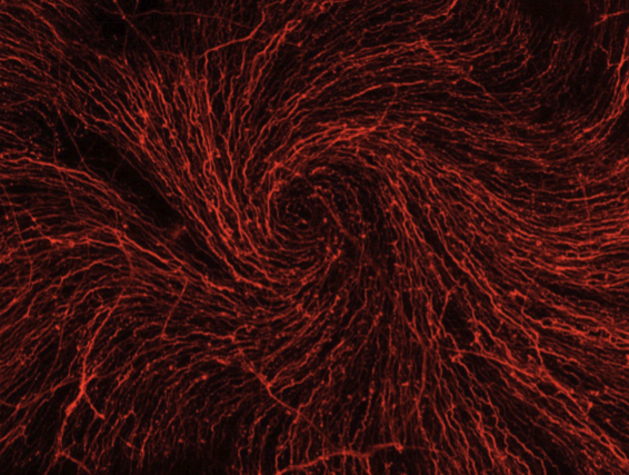 <p>A whorl-like spiral pattern of fibers </p>
