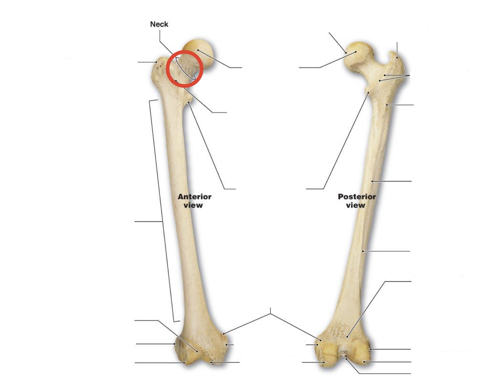 <p>Femur neck</p>