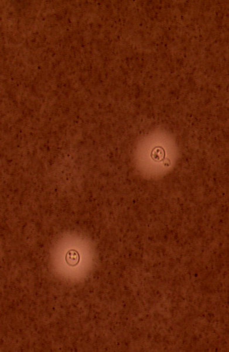 <p>Cryptococcus neoformans produces a polysaccharide capsule which is visible in an India ink preparation. India ink preparations can be performed directly on cerebrospinal fluid.</p>