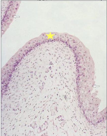 <p>does this histological slide show a relaxed or distended bladder?</p>