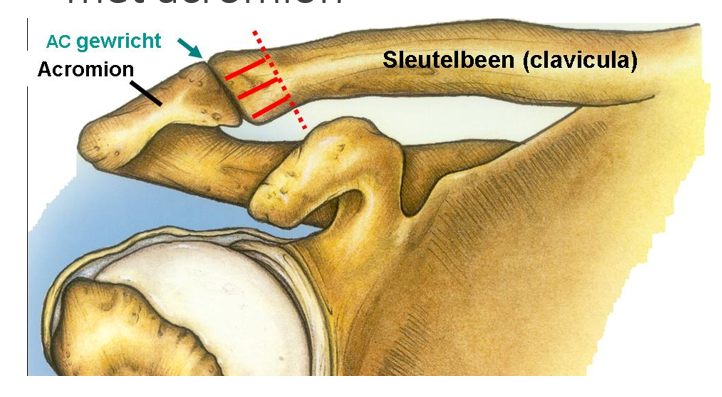 <p>links: acromion      rechts: sleutelbeen (clavicula)</p>