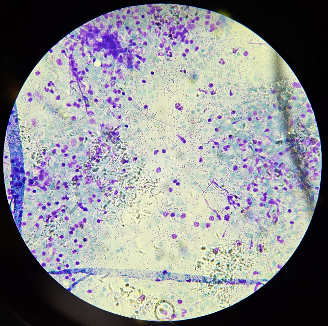 <p><span data-name="microscope" data-type="emoji">🔬</span><span data-name="petri_dish" data-type="emoji">🧫</span><strong><span> </span>Na podstawie zdjęcia preparatu:</strong></p><p></p><ul><li><p><span data-name="book" data-type="emoji">📖</span><span> </span>rozpoznaj gatunek pasożyta;</p></li></ul><p></p><ul><li><p><span data-name="recycle" data-type="emoji">♻</span><span> </span>rozpoznaj wszystkie formy rozwojowe;</p></li></ul><p></p><ul><li><p><span data-name="microbe" data-type="emoji">🦠</span><span> </span>wskaż organelle i cechy charakterystyczne dla danego gatunku;</p></li></ul><p></p><ul><li><p><span data-name="mask" data-type="emoji">😷</span><span> </span>nazwij chorobę, którą pasożyt wywołuje.</p></li></ul><p></p>