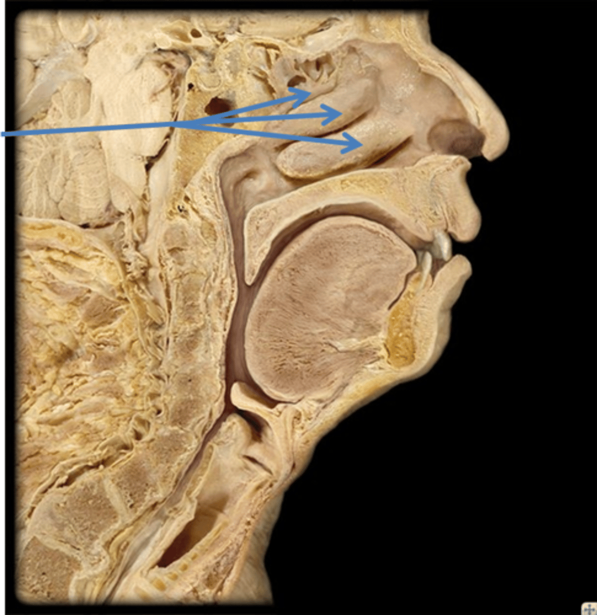 <p>Identify these structures.</p>