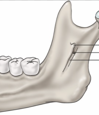 <p>what is this, its description and its appearance on images- 1st line</p>