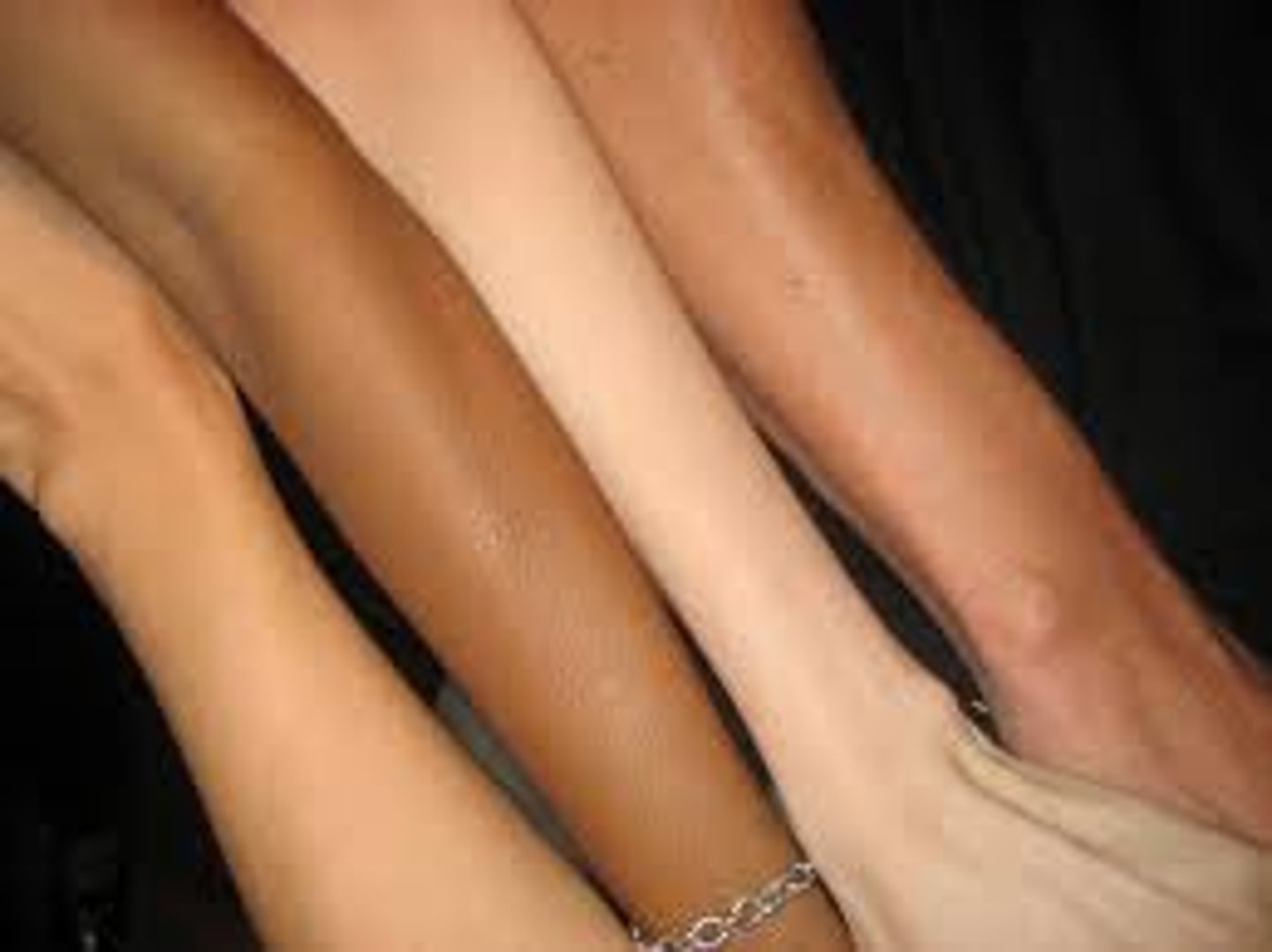 <p>Injection sites,</p><p>Blisters,</p><p>Lines of cleavage,</p><p>Decubitus ulcers (bed sores),</p><p>Burns,</p><p>Skin Cancer</p>