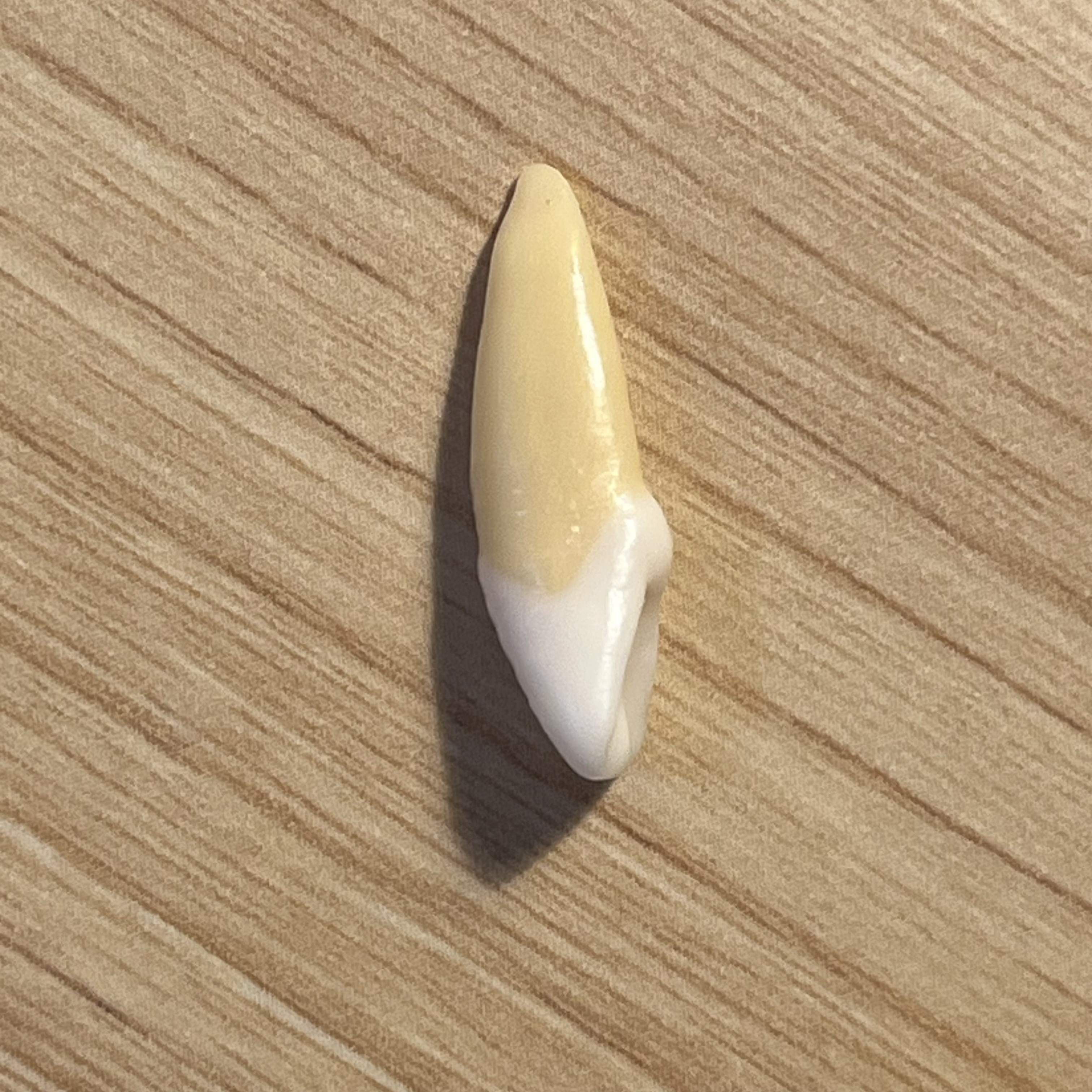 <p>What tooth is this (with view)?</p>