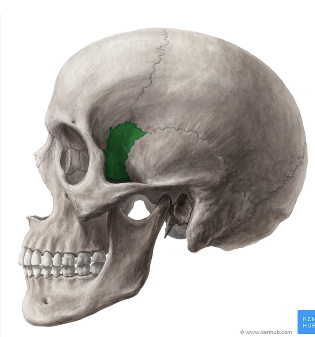 term image