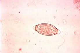 <p>Trichuris suis</p>