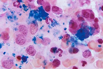 <p>What is found inside a bone?</p>