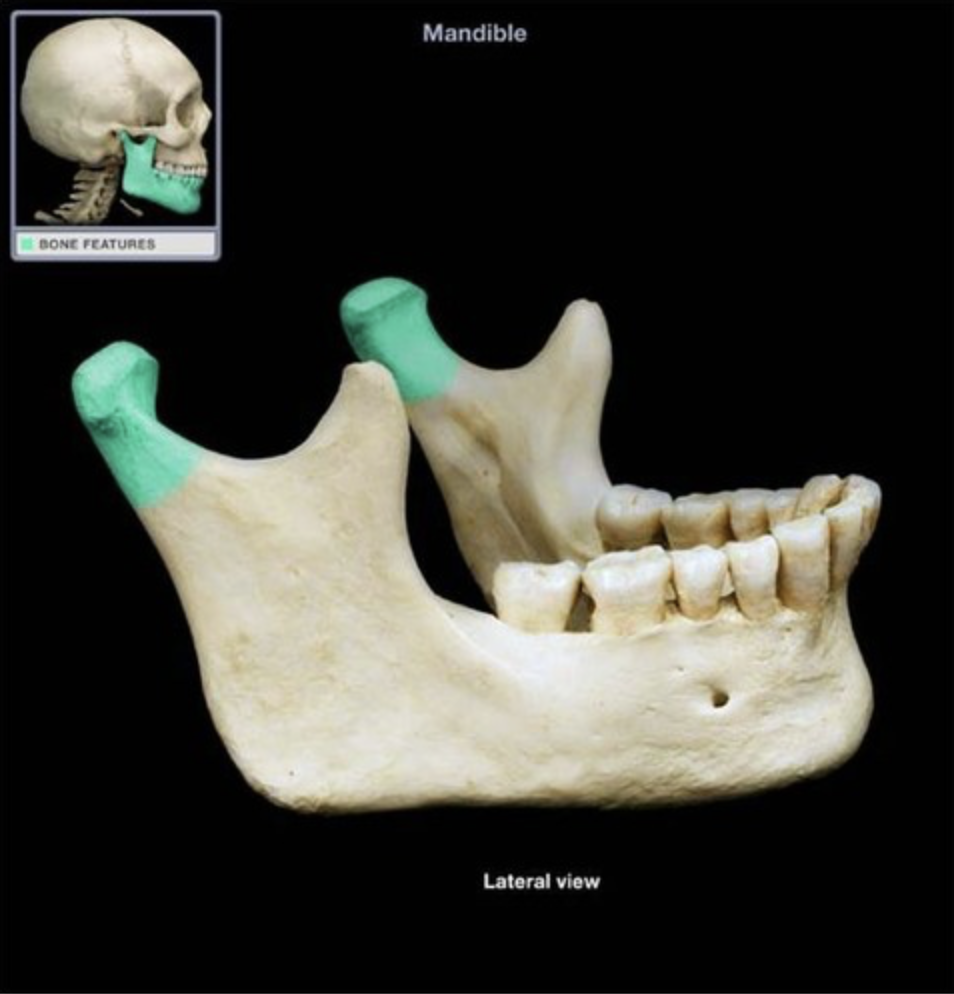 <p>rounded processes on rami that articulate with temporal bone at the mandibular fossa to form the TMJ</p>